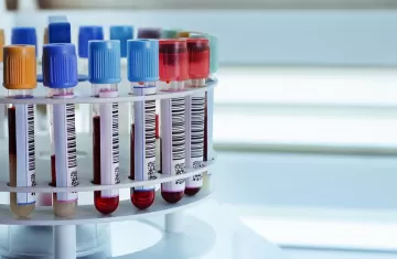 Кому нужно сдать биохимический анализ крови на показатели печени?