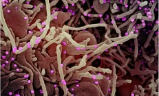 Учёные: COVID-19 напрямую поражает поджелудочную железу