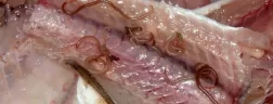 Паразиты в печени (гельминты и простейшие): признаки, диагностика и лечение