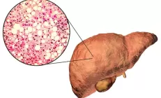 Учёные назвали нерегулярные месячные признаком заболевания печени