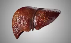 Учёные: Дисбиоз кишечника ускоряет прогрессирование стеатоза печени