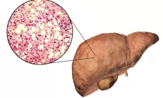 Гастроэнтеролог Якушева рассказала, как вывести лишний жир из печени