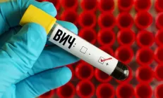 Учёные: У пациентов с ВИЧ часто развивается жировая болезнь печени