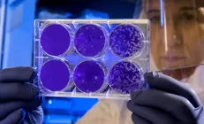 Профессор: После COVID-19 обязательно нужно проверить ферменты печени и свёртываемость крови