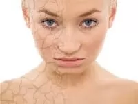 Обезвоживание