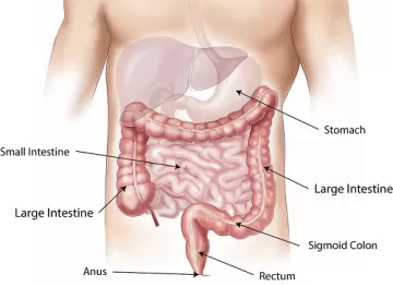 Чем питаться человеку с синдромом раздражённого кишечника?