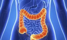 Исследование: Рак кишечника существенно «помолодел»