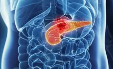 Учёным удалось победить рак поджелудочной