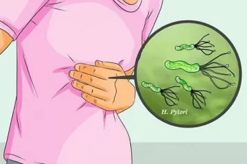 Учёные создали прибор для выявления язвы и рака желудка по дыханию