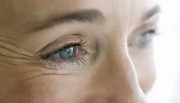 Морщины на лице напрямую связаны со старением печени
