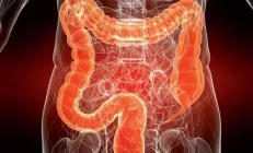 ЧТО КАТЕГОРИЧЕСКИ ЗАПРЕЩЕНО ЕСТЬ ПРИ КОЛИТЕ