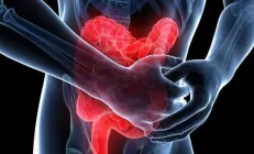 Недостаток витамина D повышает риск рецидива у больных с язвенным колитом