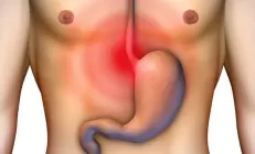 Боль под ложечкой – три возможные причины