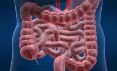 Учёные обнаружили источник развития рака кишечника