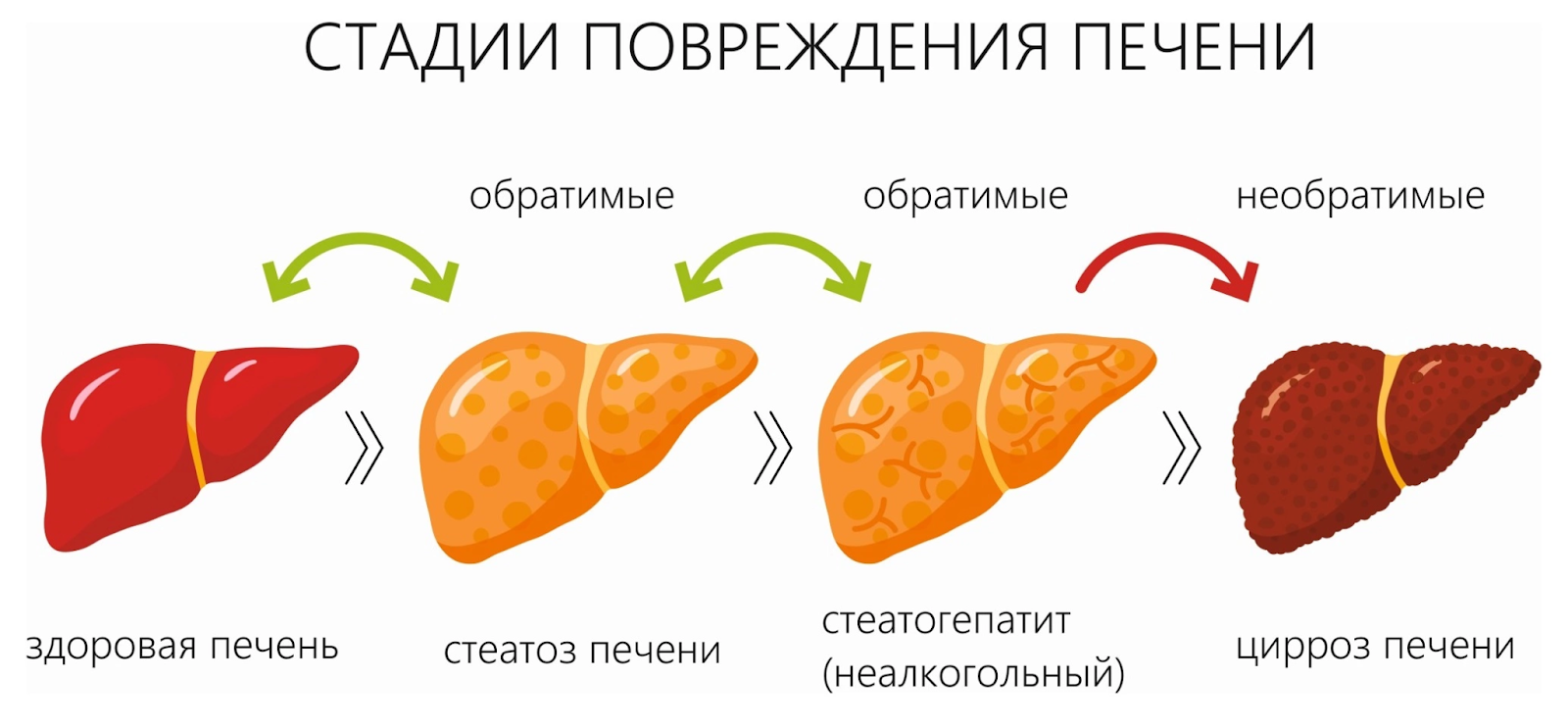 Первые признаки цирроза печени у мужчин