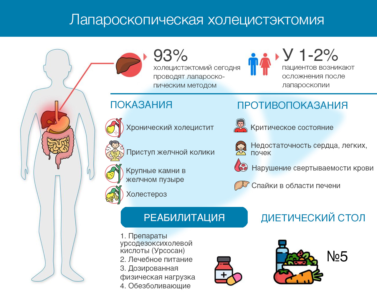 Лапароскопическая холецистэктомия — подготовка, показания, противопоказания  к операции, реабилитация